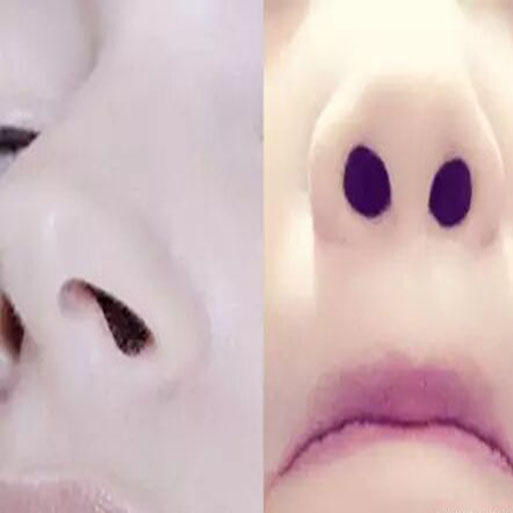 鼻孔被抠大了怎么恢复小窍门,怎么抠鼻孔不会把鼻翼抠大