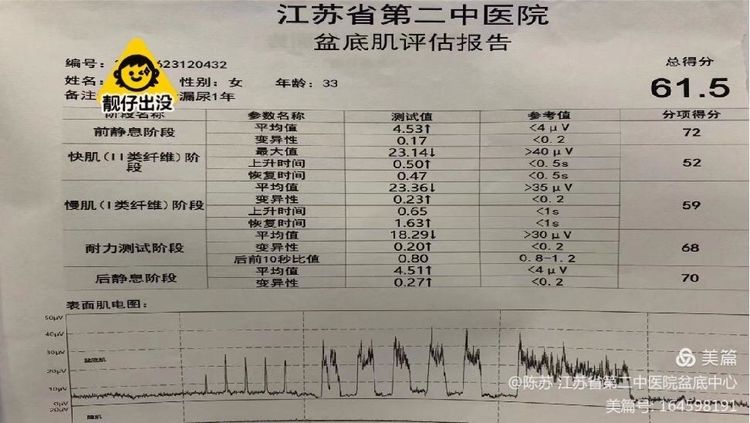 生完孩子漏尿是普遍现象吗,漏尿的真实原因
