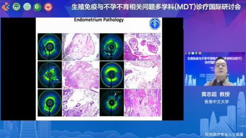 不孕不育与生殖技术研讨,不孕不育与生殖免疫