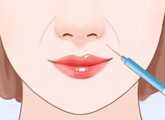 瘦脸针瘦脸详细讲解,瘦脸针瘦脸详细讲解图
