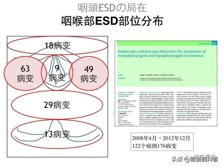 胃镜怎么做全过程,胃镜怎么做的全过程