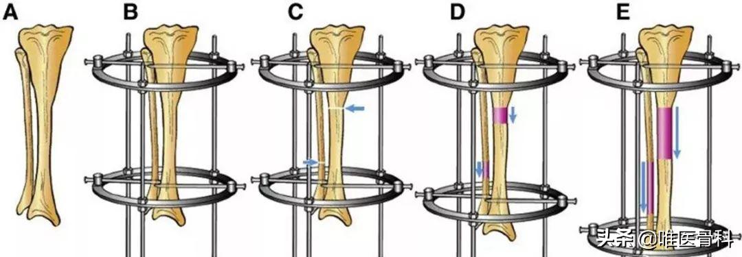 怎样练成逆天大长腿,怎样从小短腿练成大长腿