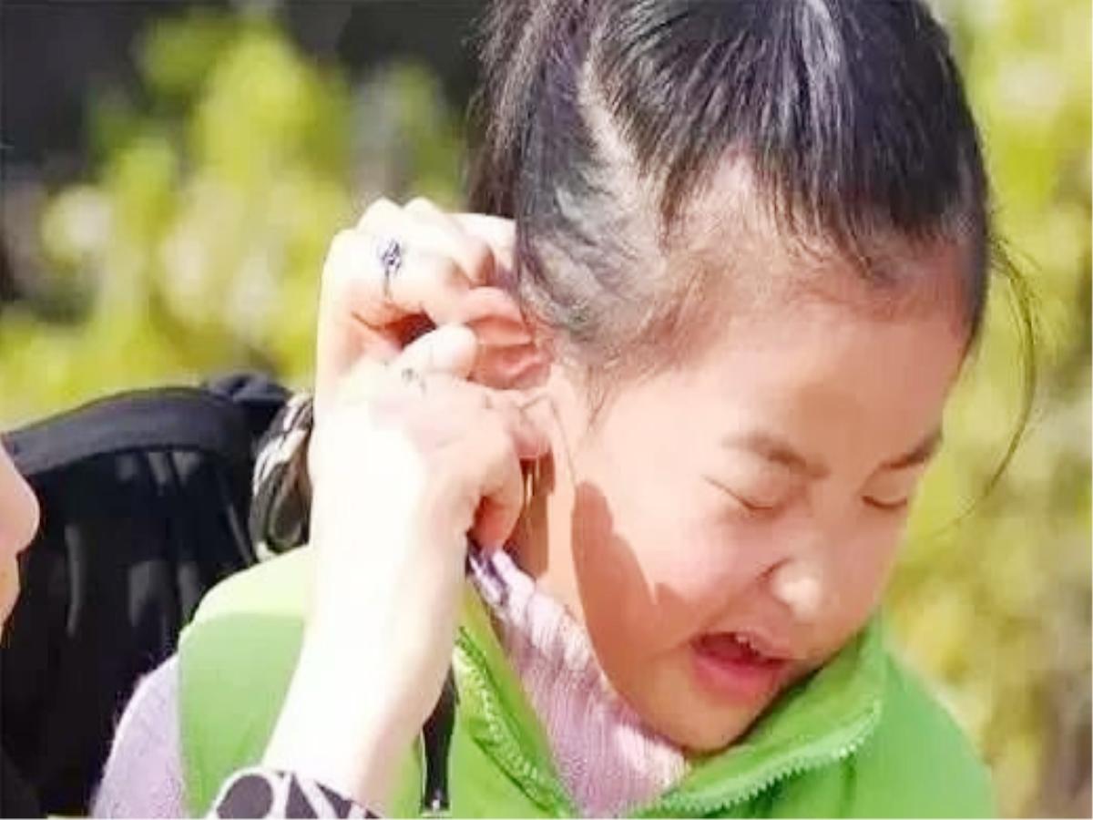 掏耳朵对宝宝听力有影响吗,掏耳朵导致鼓膜穿孔严重吗