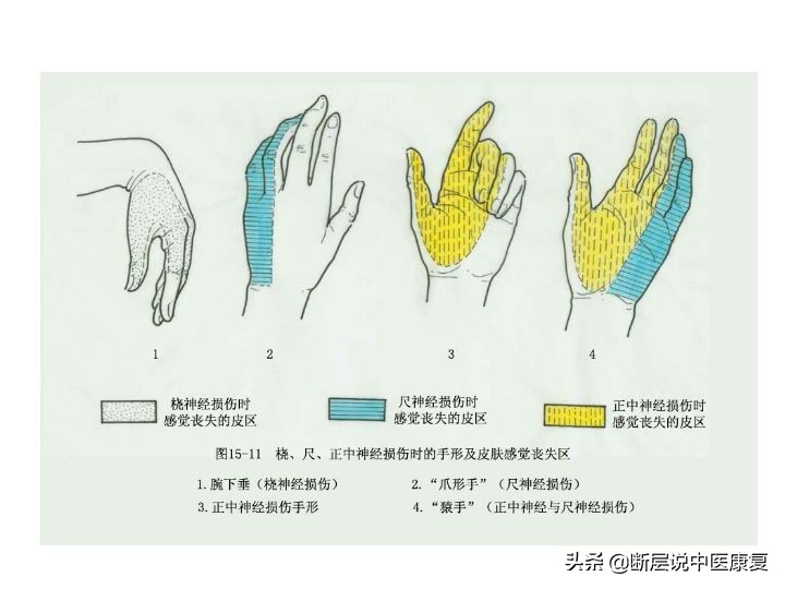 中枢神经系统断层解剖讲解,中枢神经3d解剖动画