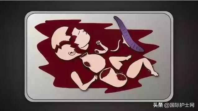 打胎有多可怕案例,20岁女生堕胎7次