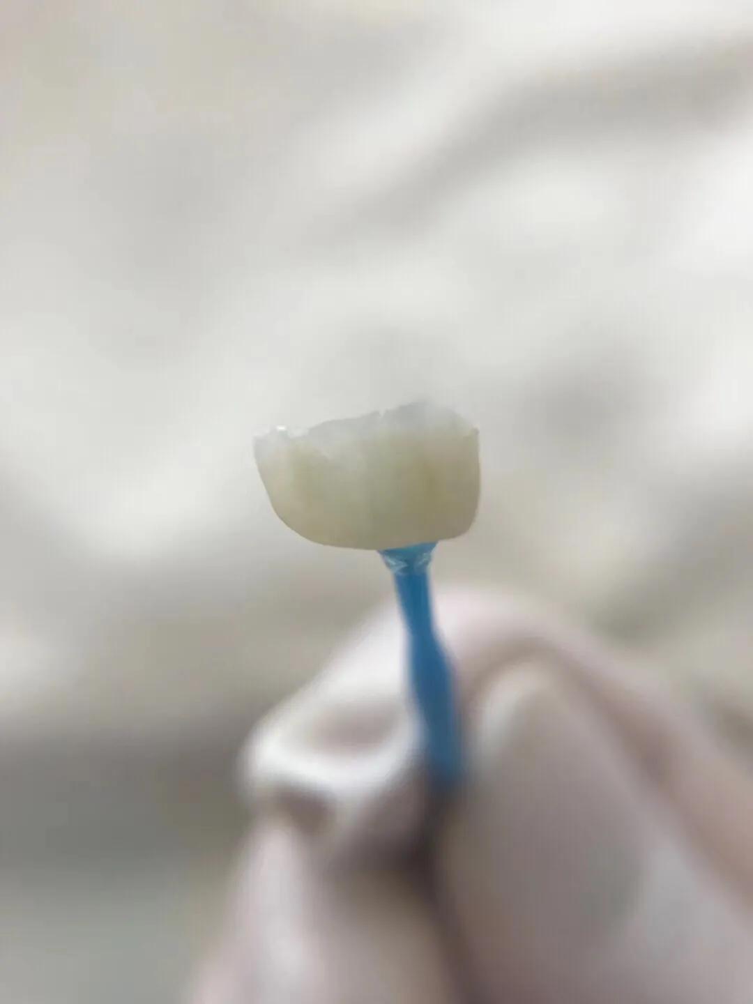 口腔垃圾怎么处理,口腔护理中的垃圾怎么分类处理