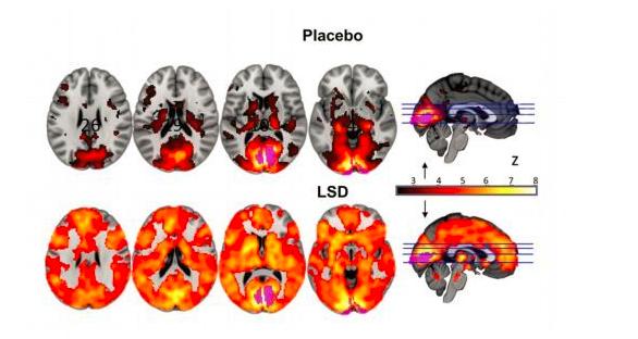 零零后贩卖“邮票”*品毒**LSD?它曾让乔布斯沉迷其中