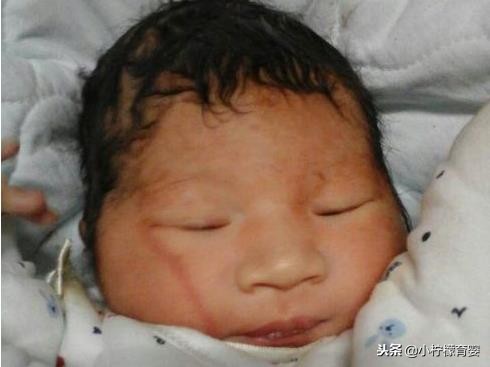 都说产钳助产危险，为什么还会有这种助产方式，对母婴影响如何？