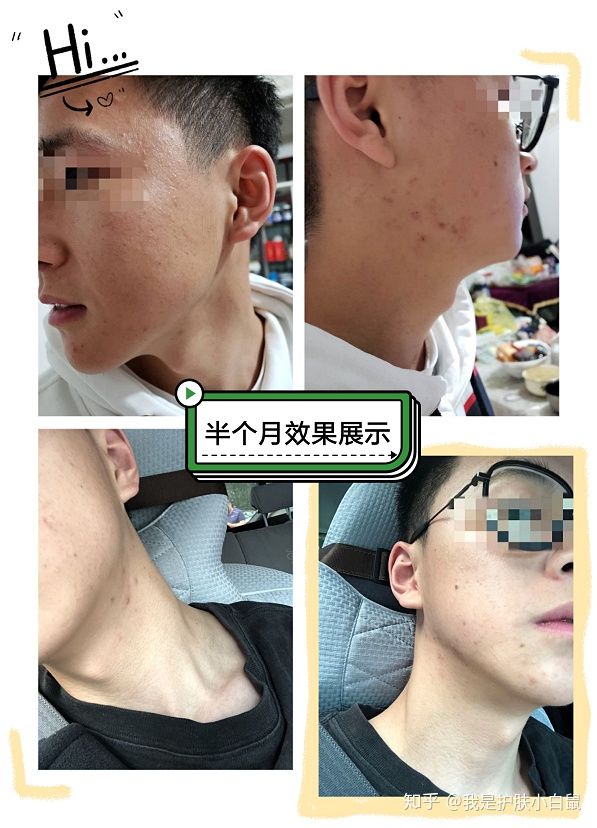 烟酰胺浓度不是越高越好，你知道么？