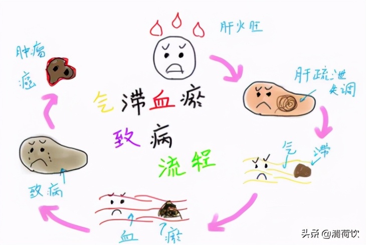 深读：那些“泡”在酒里的肝，后来都还好吗？