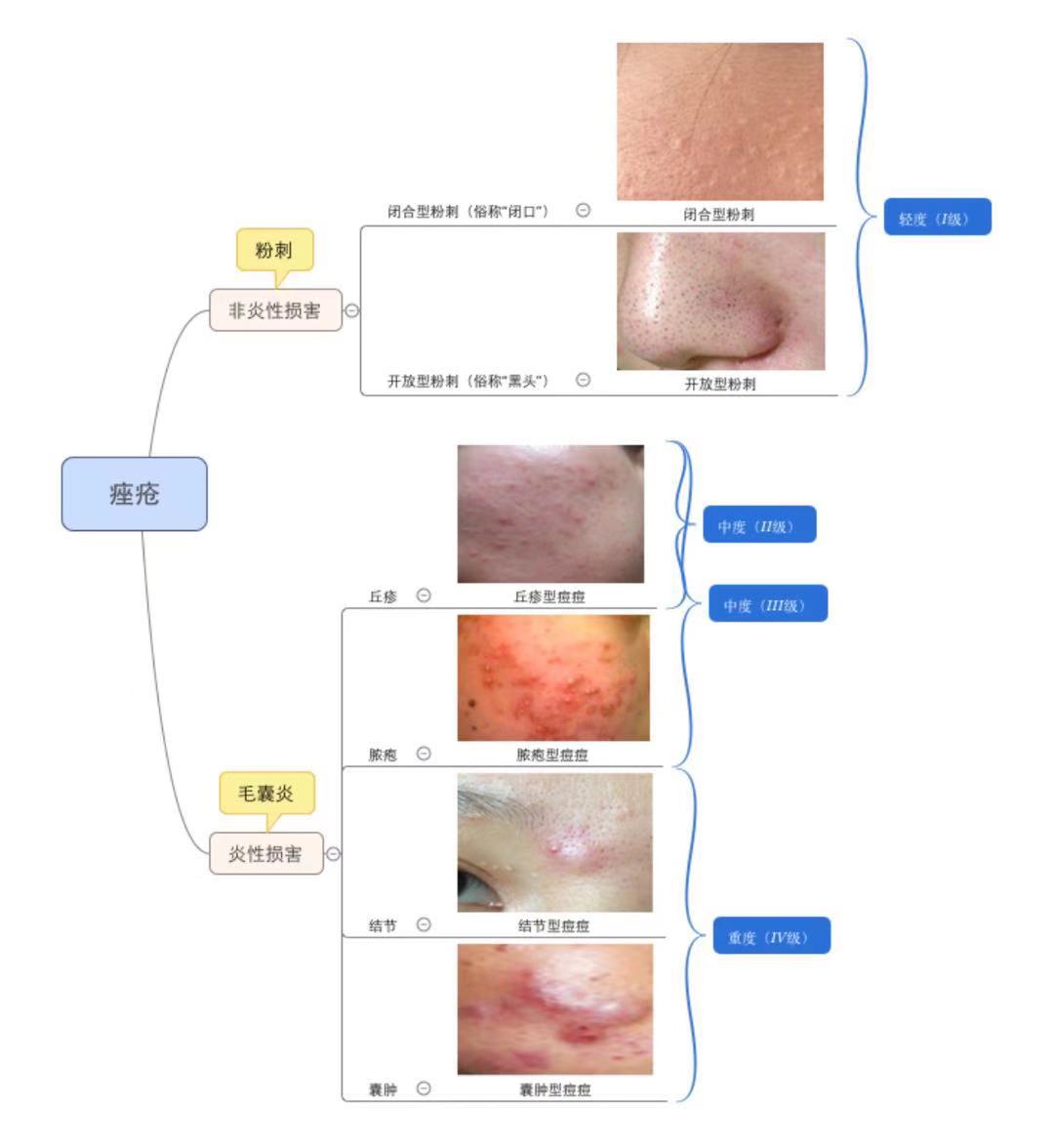 青春期痘痘知识科普微视频,女性小痘痘的科普
