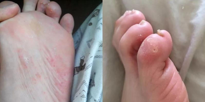 穿几十块的鞋会脚臭吗,穿几十块钱的鞋子臭脚吗