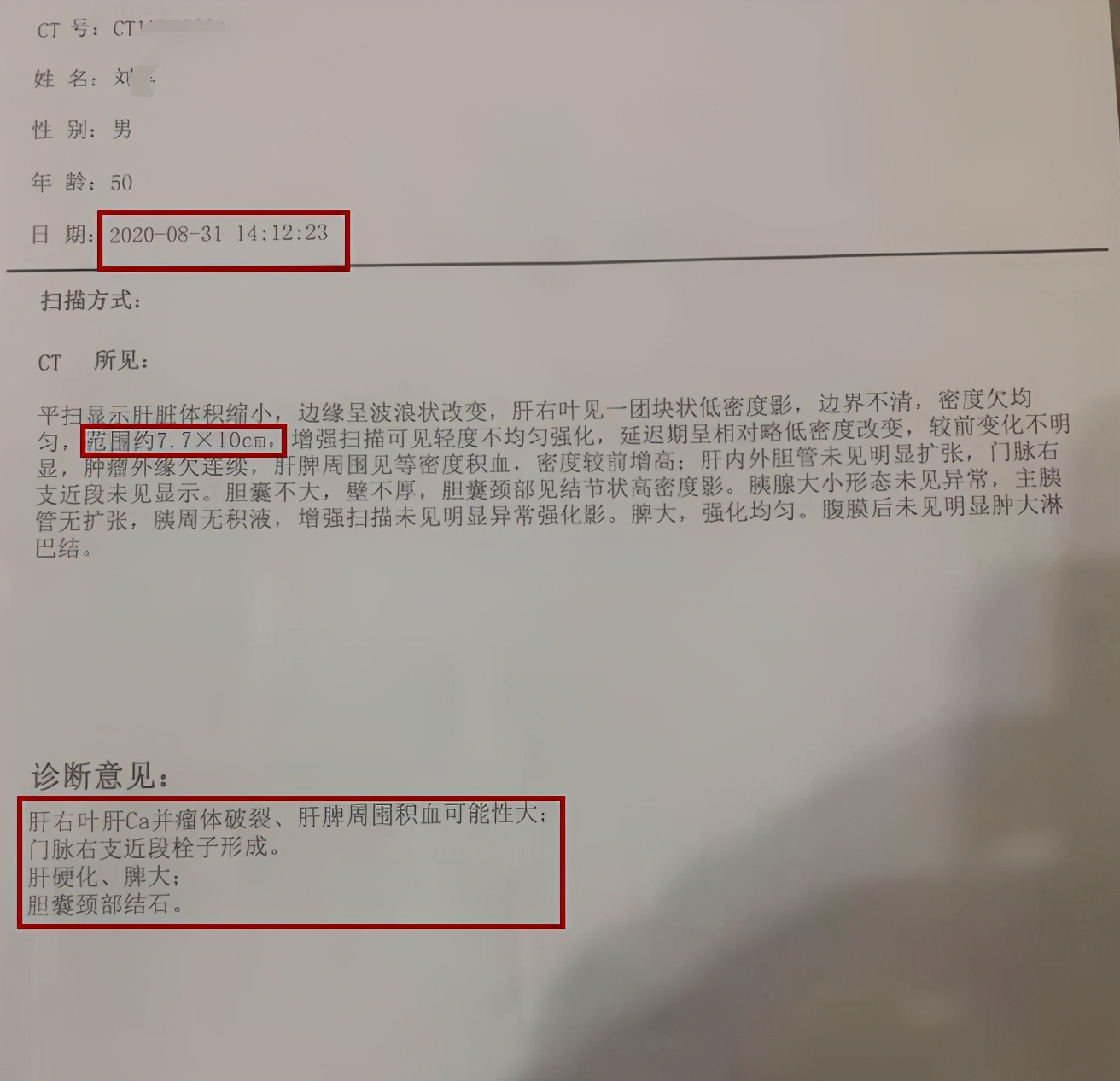 中西结合治疗肝癌效果如何,肝癌肿瘤破裂出血怎么治疗