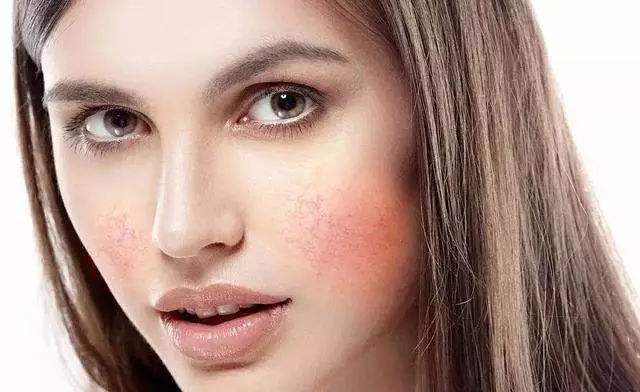 洗脸后干燥起皮不用洗面奶,洗脸后干燥起皮一会又很油