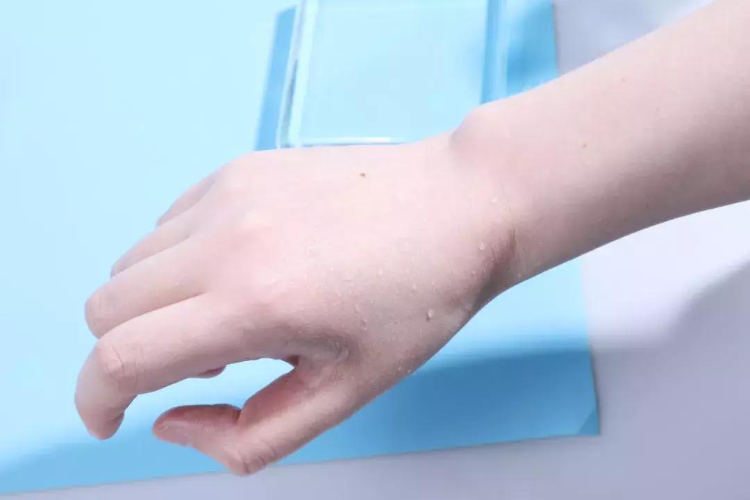 拿什么拯救你我的春日敏感肌,拿什么拯救你我的冬季敏感肌