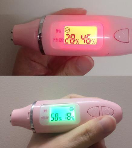 打玻尿酸和瘦脸针有什么后遗症,瘦脸针玻尿酸危害