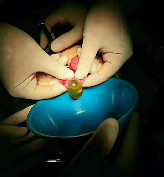 水宝宝毒性能维持多久,水宝宝有没有毒性物质