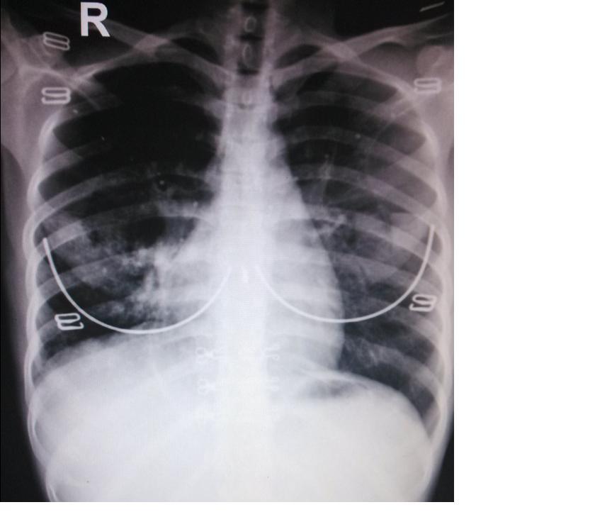 胸透检查时，男医生要求女患者*光脱**上衣，到底是治病还是性侵？