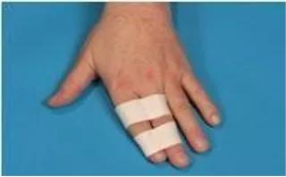 运动损伤的治疗与康复知识点,运动损伤的诊治