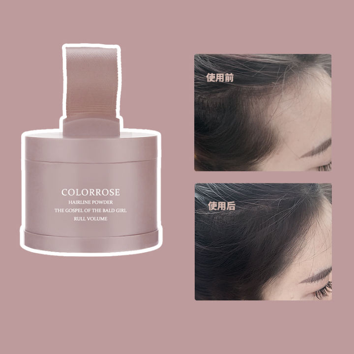 秃头有救了神器,秃头女孩轻松get高颅顶蓬松头发