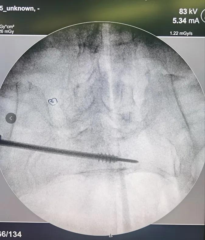 摘取皇冠,聊城市人民医院骨外科