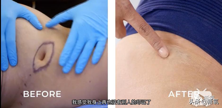 刘诗诗最近生图,刘诗诗旧照脸又胖又大