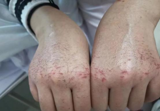 宋茜儿童,宋茜香菜味护手霜