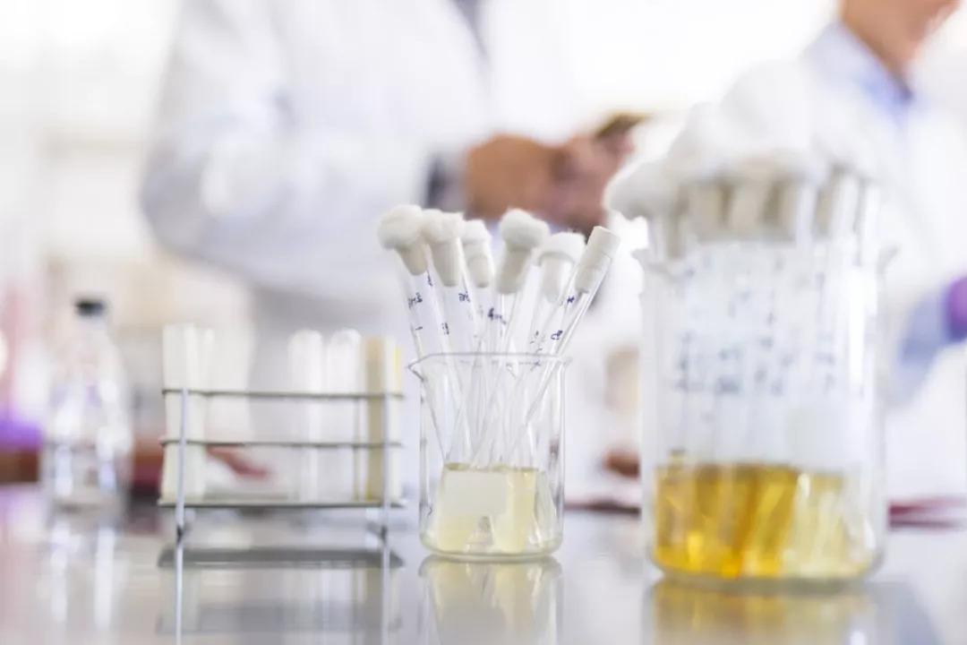 尿糖一般几个加号是糖尿病,尿糖跟糖尿病有什么区别