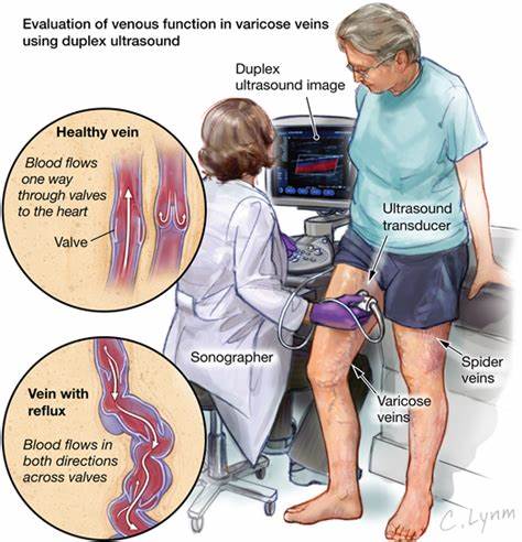 静脉曲张术前及术后注意事项,静脉曲张术前有哪些禁忌