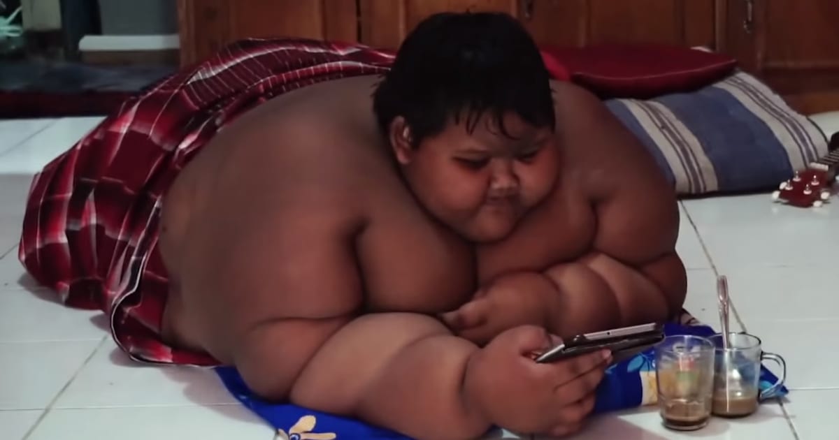 儿童肥胖近视产生的原因,青少年近视肥胖等问题备受关注