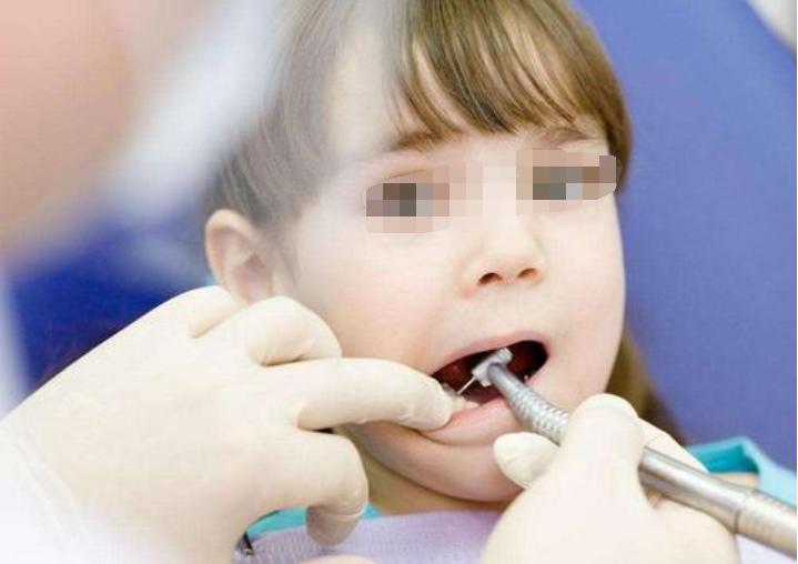 儿童大牙龋齿严重该怎么办,儿童牙有龋齿应该怎么治疗