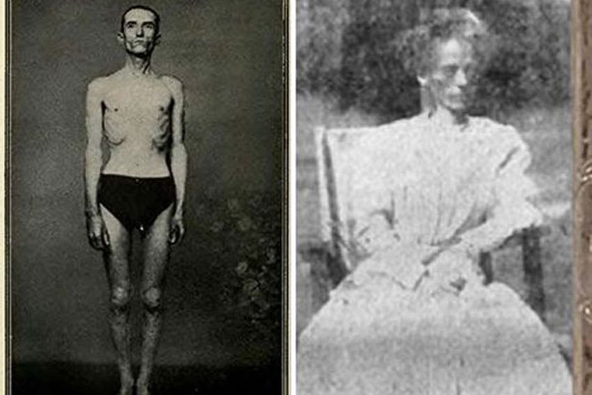 推崇并声称禁食可以治疗一切疾病，结果饿死了一群病人