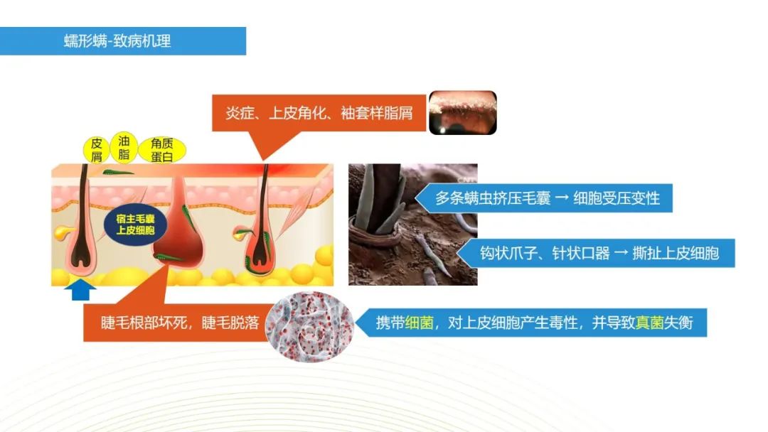 眼睛总是痒？总感觉眼睛里有东西？结膜炎角膜炎反反复复？可能是你的眼睛里有螨虫