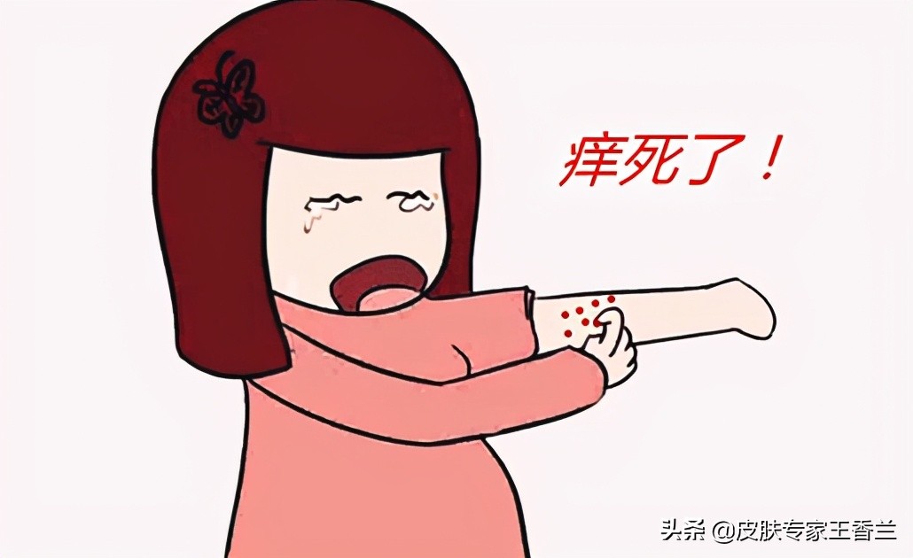 天气变暖身上就起癣是怎么回事,体癣天气越冷越严重