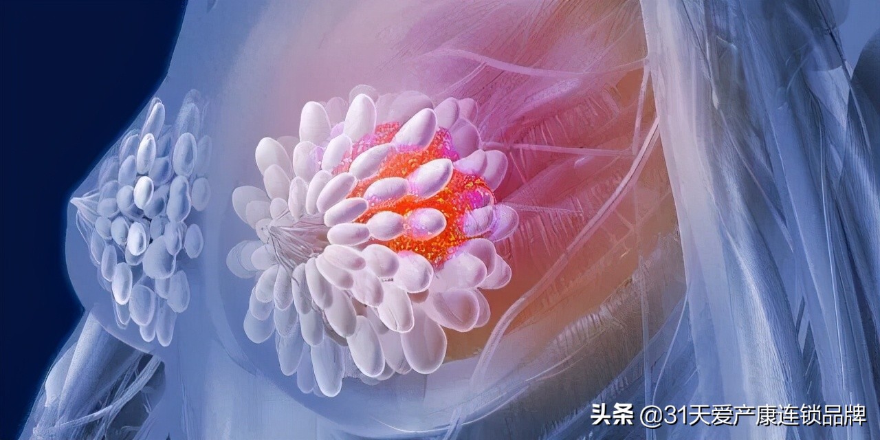 新手妈妈：史上最全乳房护理攻略