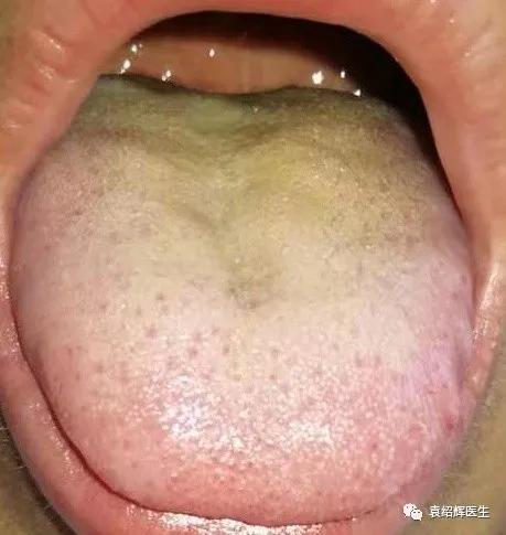 疮痂病水果吃了的危害,所有水果对人体有害吗