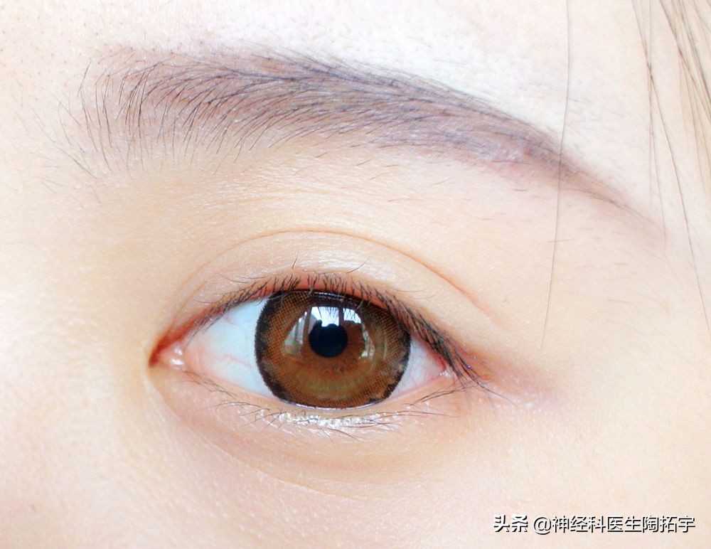 眼球人体解剖学讲解,眼睛解剖讲解