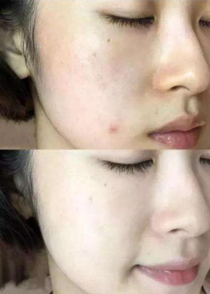 药店那些不起眼的国货护肤品,药店便宜好用的软膏