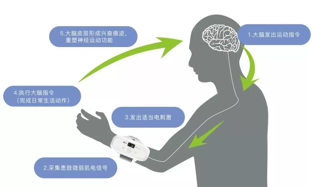 h1医疗保健,h13手指功能训练器