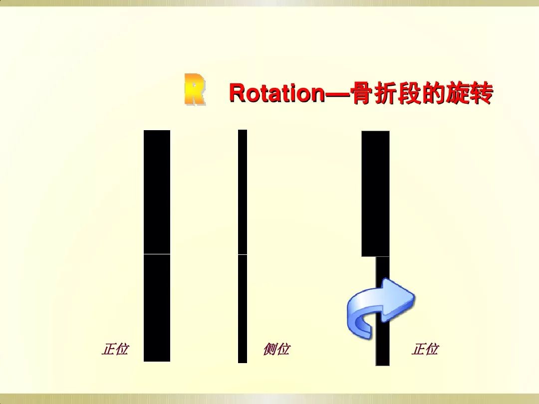 骨科x光片读片技巧,放射科骨科读片教程