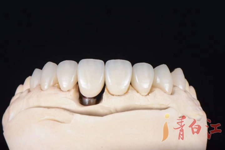 你的牙够干净吗,你的牙现在还好吗