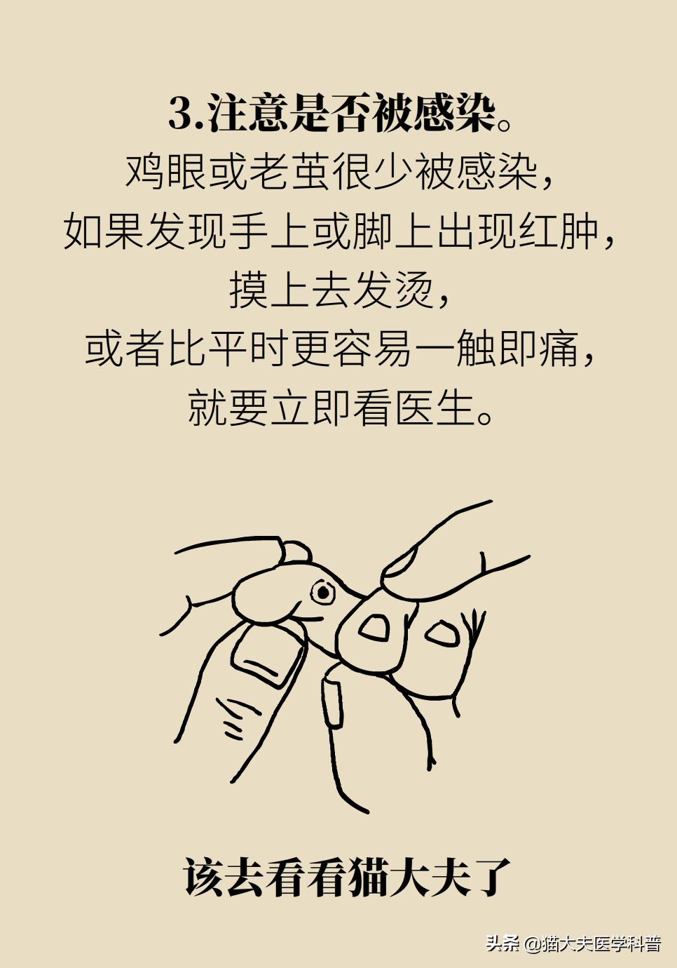 鸡眼好了长了一层老茧,鸡眼与老茧的区别图片