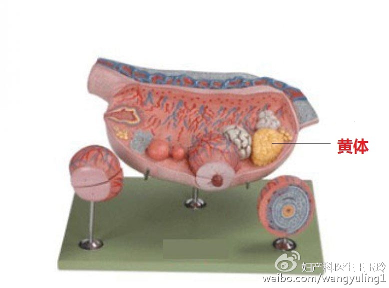 *生活性**后腹痛，原来是黄体破裂惹的祸