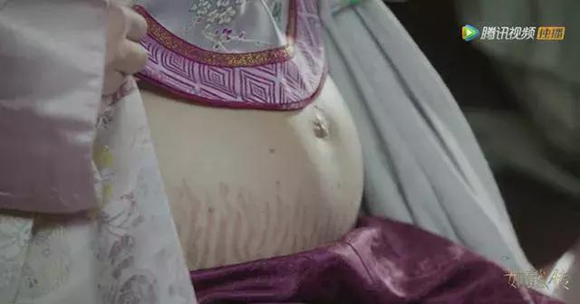 长妊娠纹了怎么办,胸长妊娠纹怎么办