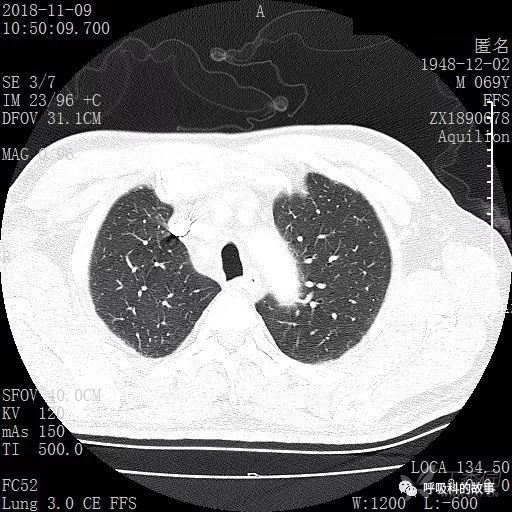 怎么应用统计学做调查,统计学方法可以解决的主要问题