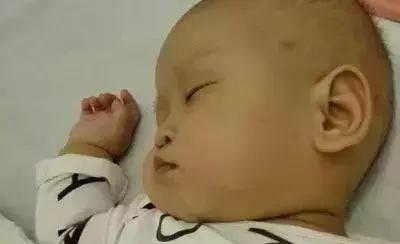 新生儿皮肤问题怎么解决,家有新生儿怎么办