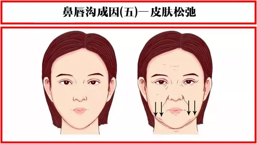 法令纹显老10岁三种方法帮助改善,最显老的法令纹怎么改善