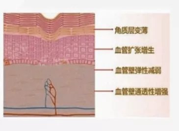 *血丝红**的自救指南,大家快来抄作业