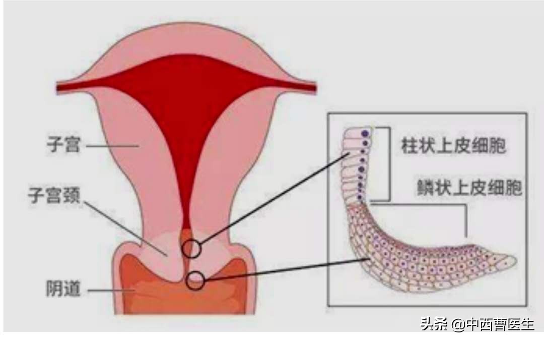 淋病除了性传播还有什么传播,淋病是性传播主要原因吗