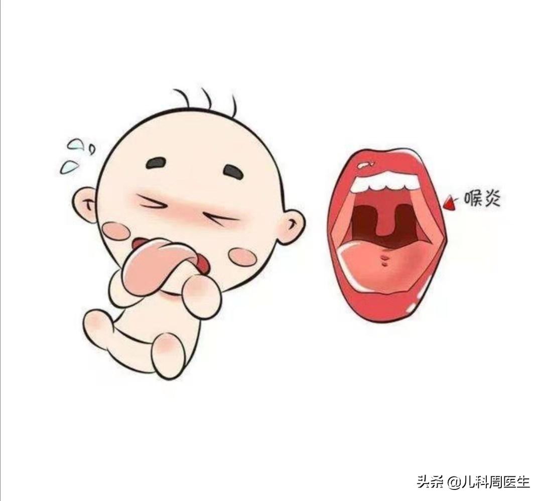 儿童喉炎犬吠样声音怎么治疗,犬吠样咳嗽吸气性喉鸣处理方法